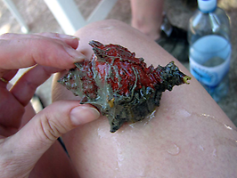 Purpurschnecke Purpurschnecke